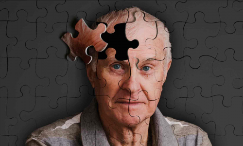 Деменция — эпидемия XXI века. Что это за болезнь?