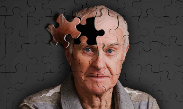 Деменция — эпидемия XXI века. Что это за болезнь?